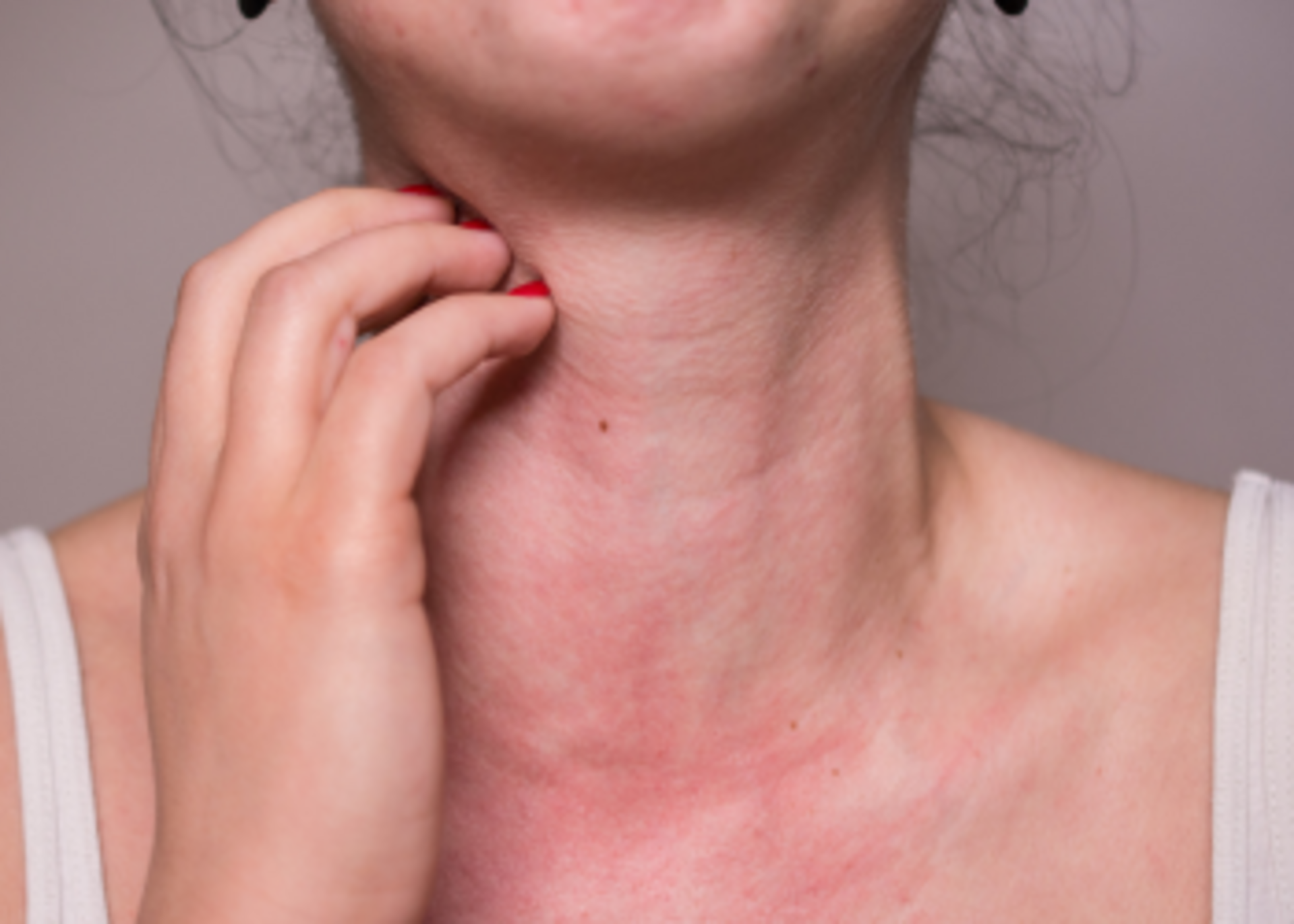 llergy Treatment